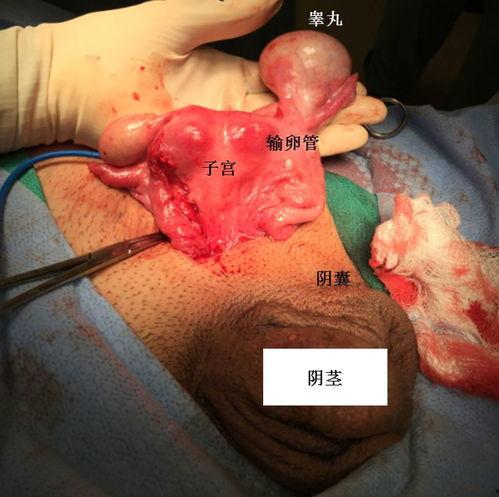 女人阴口图片,阴口之美与护理